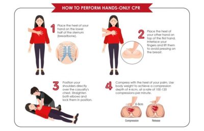 胸骨予防策とは何ですか?